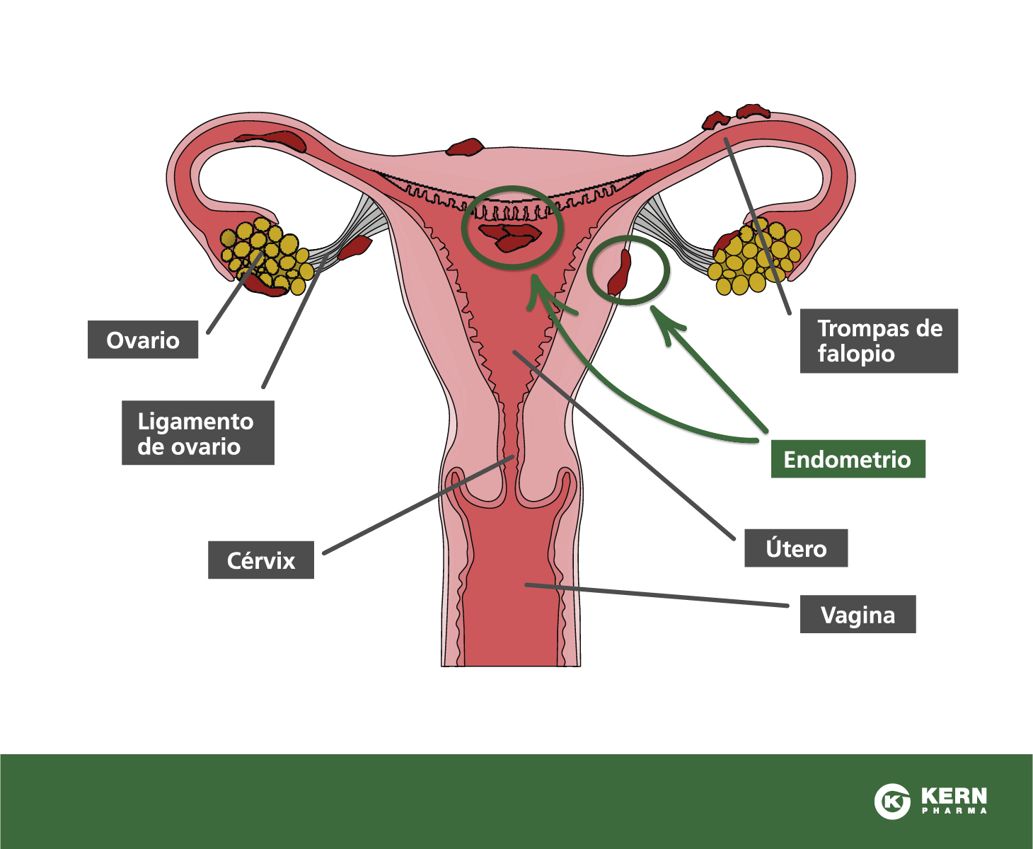 Menstruacion tratamiento con ovulos y